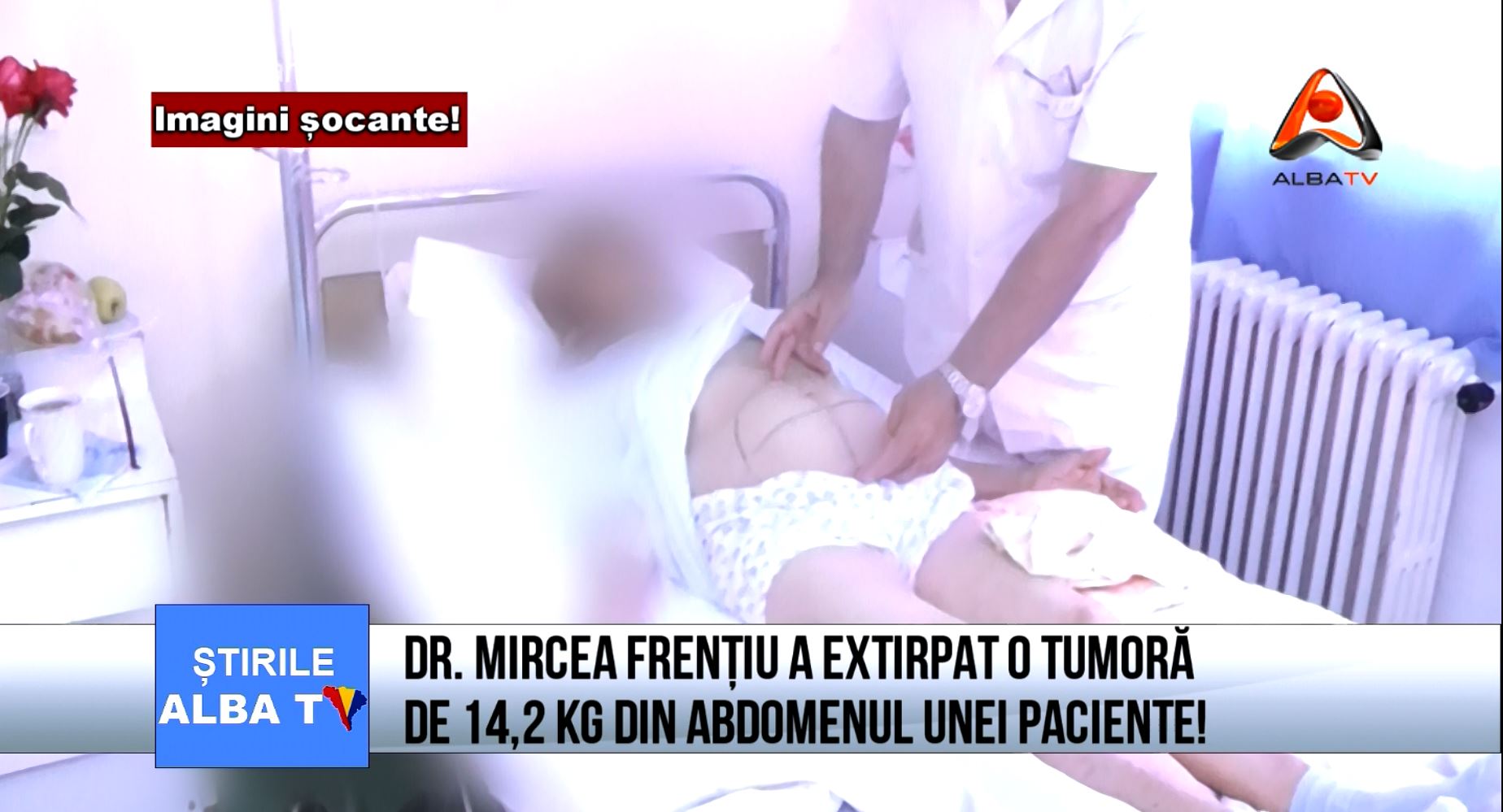 dr-mircea-frentiu-a-extirpat-o-tumora-de-14,2-kg-din-abdomenul-unei-paciente